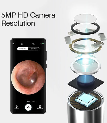 Wireless Visual Ear Endoscope Camera Ear Cleaning Tools Spoon Safe Silicone Earpick 5MP Camera Ear Wax Remover Luminous Otoscope